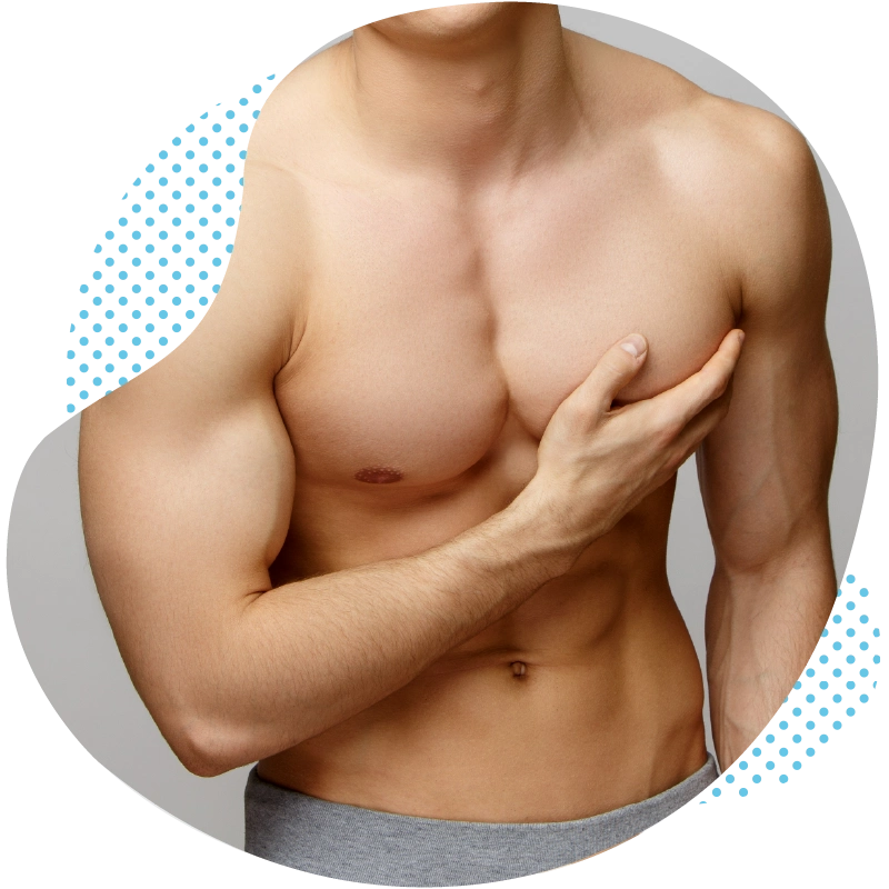 Male breast removal in Turkey Antalya – gynaecomastia treatment