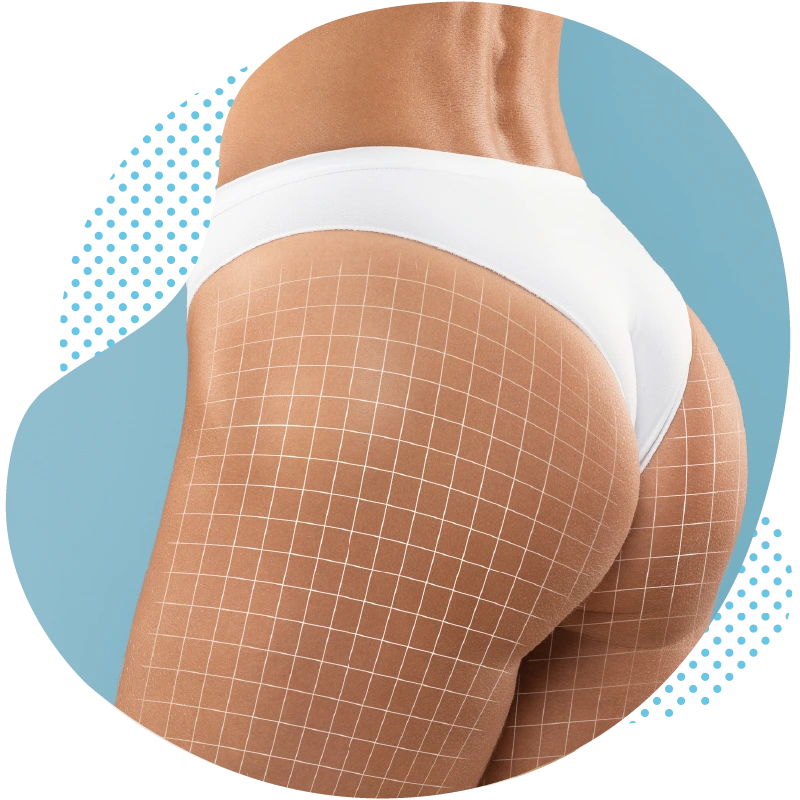 Optimal solutions for buttock lift in Antalya Turkey