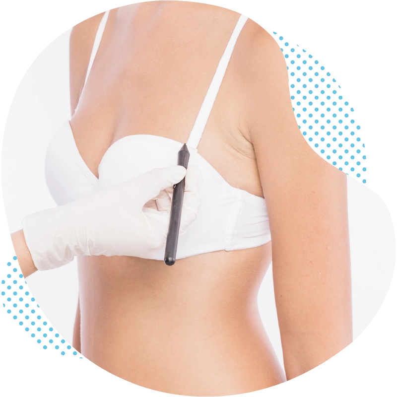 Breast reduction in Antalya Turkey – Consultation planning