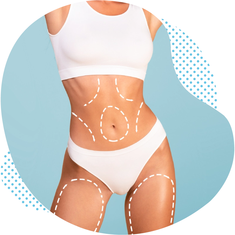 Liposuction in Antalya Turkey Comprehensive advice and individualized treatment concept