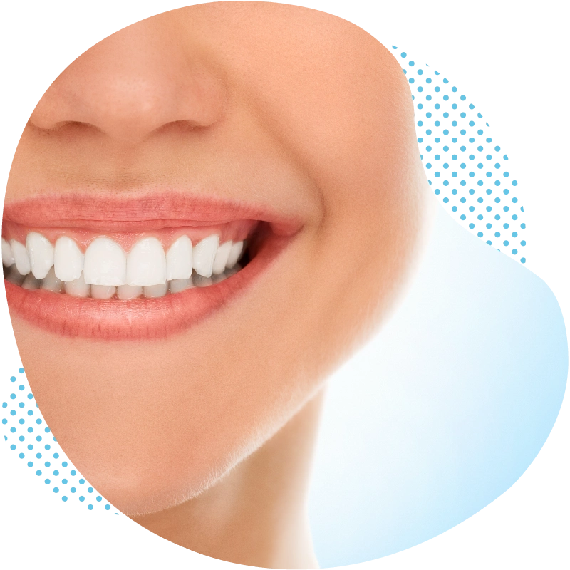 The whitening treatment for your teeth – Function & mode of action
