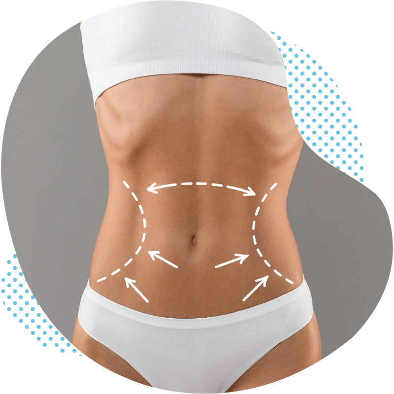 Tummy Tuck Antalya – Consultation With Experts