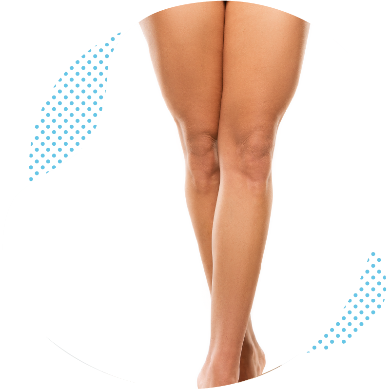 How do the Turkish cosmetic surgeons perform a thigh lift