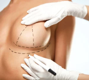 7 Ways Breast Lift Surgery Can Enhance Your Confidence and Body Image: Changing Your Lifestyle with Plastic Surgery