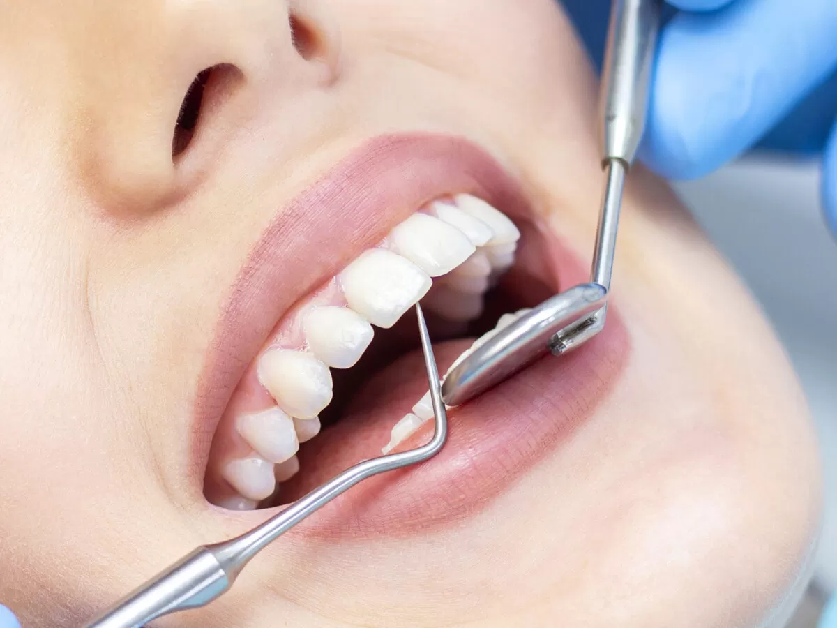 Advanced Dental Procedures Offered in Antalya / Turkey