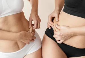 Conclusion: Tummy Tuck vs. Liposuction: 8 Key Factors to Consider for Your Body Goals